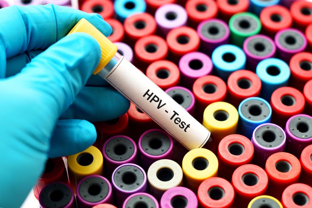 Formation médicale sur la prévention et la prise en charge des lésions cancéreuses dues au virus HPV en dpc